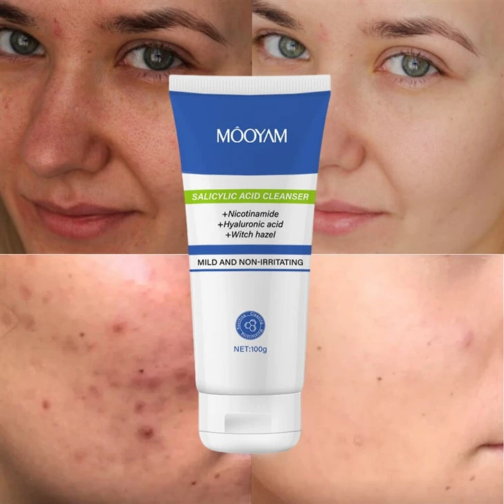 Organic Amino Acid Facial 2% Salicylic Acid Reduce Acne Foam Cleanser